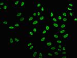 H2BK15ac Antibody in Immunocytochemistry (ICC/IF)