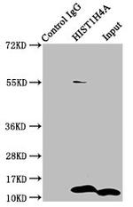 H4K5cr Antibody in Immunoprecipitation (IP)