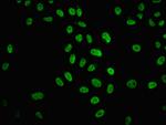 H4K31ac Antibody in Immunocytochemistry (ICC/IF)