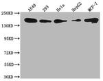 PLXNB2 Antibody in Western Blot (WB)