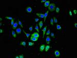 SNRPD1 Antibody in Immunocytochemistry (ICC/IF)