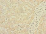 SOAT2 Antibody in Immunohistochemistry (Paraffin) (IHC (P))