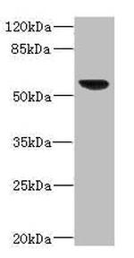 SOAT2 Antibody in Western Blot (WB)