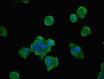 TPK1 Antibody in Immunocytochemistry (ICC/IF)