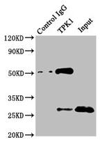 TPK1 Antibody in Immunoprecipitation (IP)