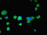 TPPP2 Antibody in Immunocytochemistry (ICC/IF)