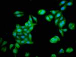 ZNF703 Antibody in Immunocytochemistry (ICC/IF)