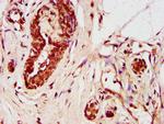 ZNF703 Antibody in Immunohistochemistry (Paraffin) (IHC (P))