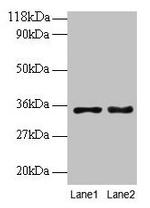 PTDSS1 Antibody in Western Blot (WB)