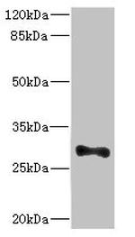 ICAM-4 Antibody in Western Blot (WB)