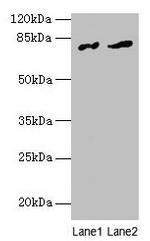 FAM161A Antibody in Western Blot (WB)