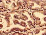 YIF1B Antibody in Immunohistochemistry (Paraffin) (IHC (P))