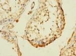 DHX32 Antibody in Immunohistochemistry (Paraffin) (IHC (P))