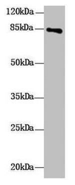 DHX32 Antibody in Western Blot (WB)