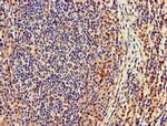 CASC1 Antibody in Immunohistochemistry (Paraffin) (IHC (P))