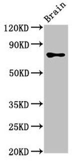 CASC1 Antibody in Western Blot (WB)