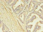 SLC25A25 Antibody in Immunohistochemistry (Paraffin) (IHC (P))