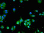 SLC13A5 Antibody in Immunocytochemistry (ICC/IF)