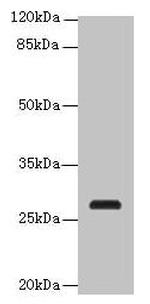 C17orf64 Antibody in Western Blot (WB)