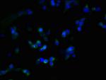 ZDHHC23 Antibody in Immunocytochemistry (ICC/IF)