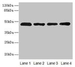 ZDHHC23 Antibody in Western Blot (WB)