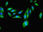 MCPH1 Antibody in Immunocytochemistry (ICC/IF)