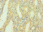 MCPH1 Antibody in Immunohistochemistry (Paraffin) (IHC (P))