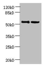 UTP15 Antibody in Western Blot (WB)