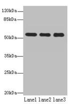 TBC1D22A Antibody in Western Blot (WB)