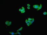 ST8SIA2 Antibody in Immunocytochemistry (ICC/IF)