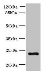 PQLC3 Antibody in Western Blot (WB)