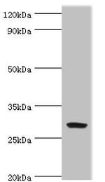 SPIN2 Antibody in Western Blot (WB)