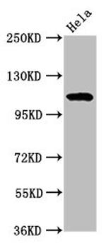 NAT10 Antibody in Western Blot (WB)