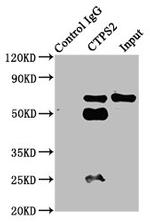 CTPS2 Antibody in Immunoprecipitation (IP)