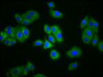 SLC4A5 Antibody in Immunocytochemistry (ICC/IF)