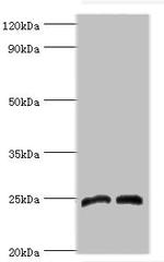 DKK4 Antibody in Western Blot (WB)