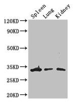 ALKBH4 Antibody in Western Blot (WB)