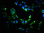 VIPAS39 Antibody in Immunocytochemistry (ICC/IF)