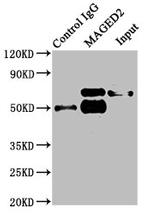 MAGED2 Antibody in Immunoprecipitation (IP)