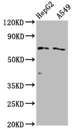 OATP2 Antibody in Western Blot (WB)