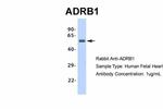 beta-1 Adrenergic Receptor Antibody in Western Blot (WB)
