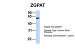 ZGPAT Antibody in Western Blot (WB)