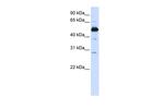 FAM134B Antibody in Western Blot (WB)