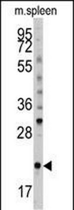 BID Antibody in Western Blot (WB)