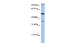 TEM7 Antibody in Western Blot (WB)