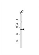 BAD Antibody in Western Blot (WB)