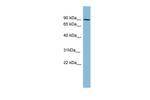 PKC beta-1 Antibody in Western Blot (WB)