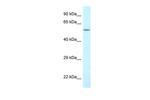 CTPS2 Antibody in Western Blot (WB)