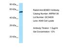 BCMO1 Antibody in Western Blot (WB)