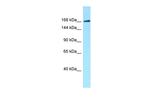 MAST1 Antibody in Western Blot (WB)